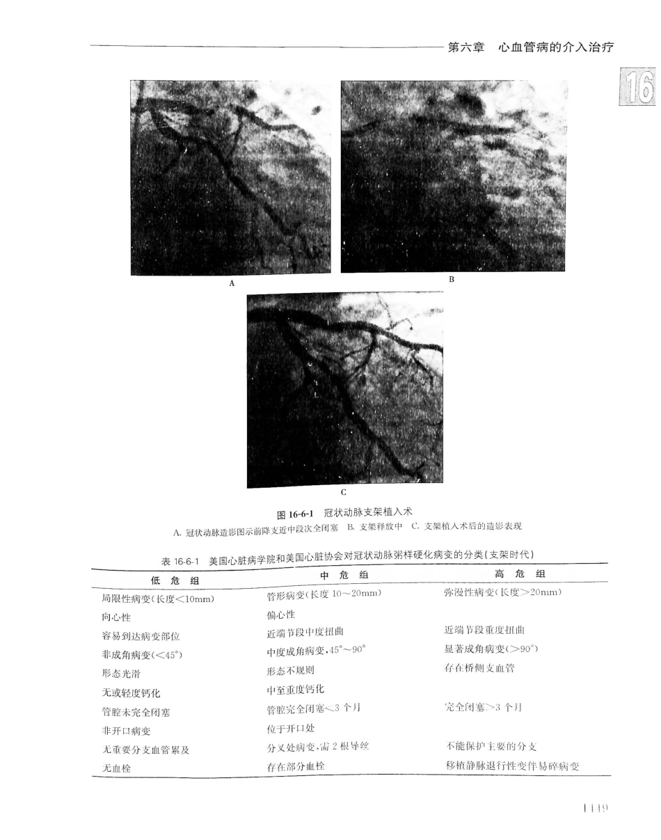 实用内科学（下册）人卫第14版_141-160.pdf_第2页