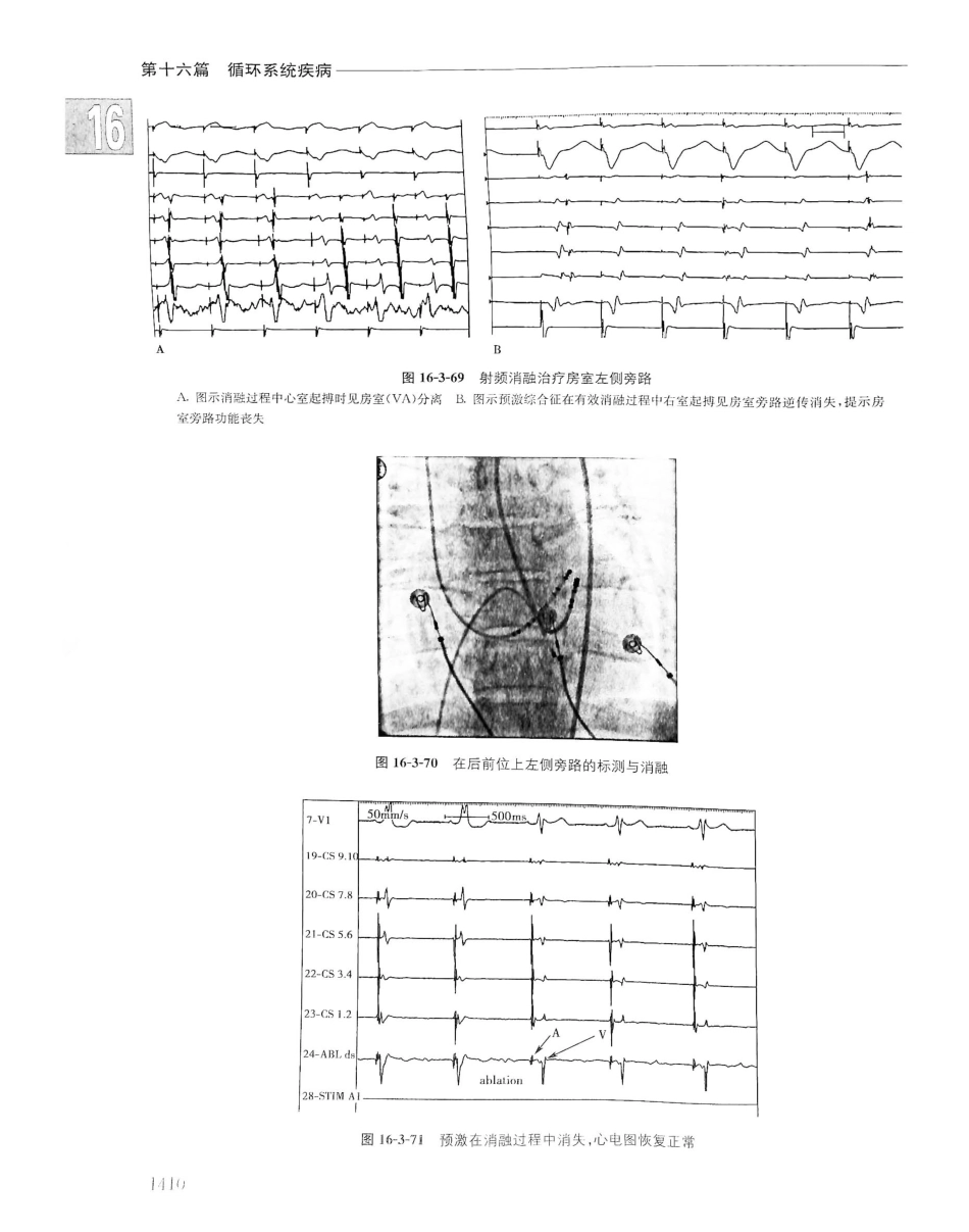 实用内科学（下册）人卫第14版_101-120.pdf_第3页