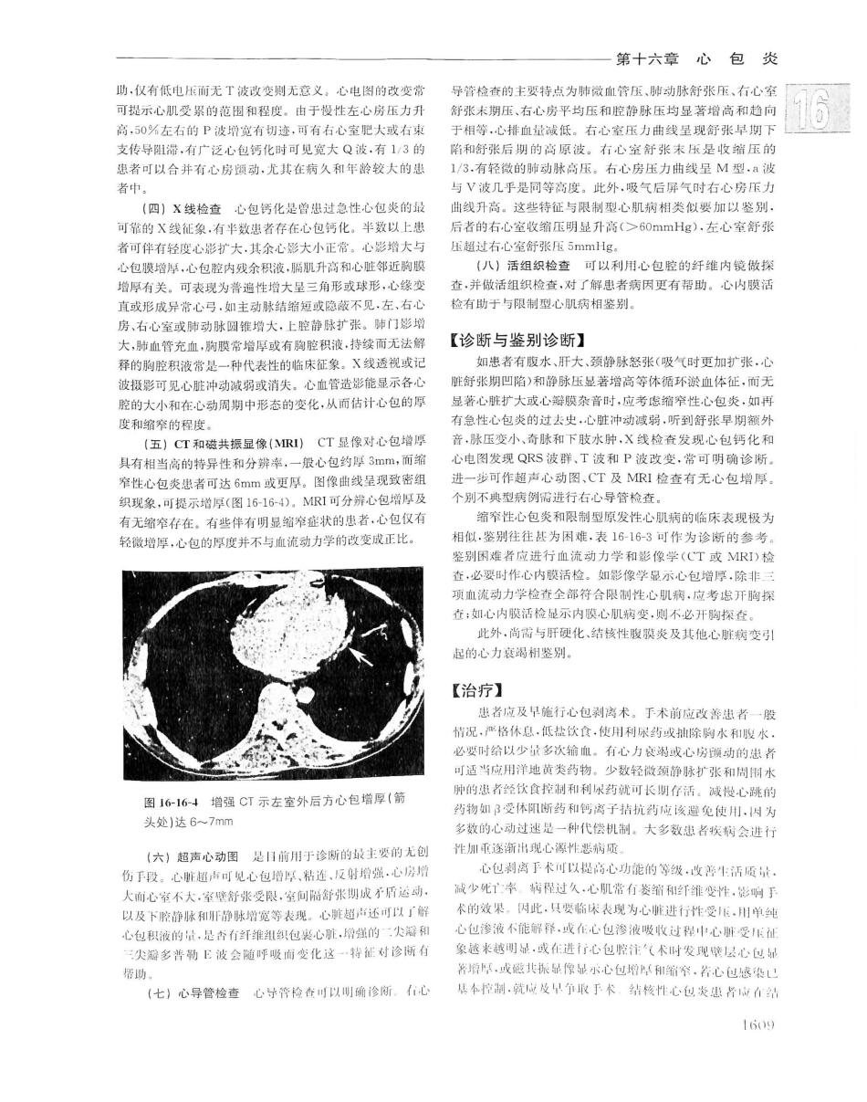 实用内科学（下册）人卫第14版_301-320.pdf_第2页