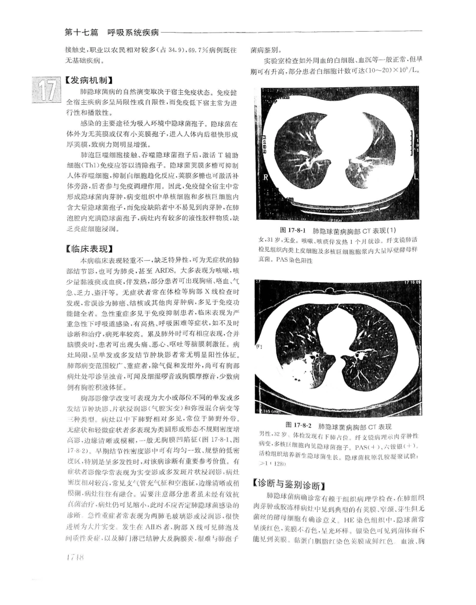 实用内科学（下册）人卫第14版_441-460.pdf_第1页