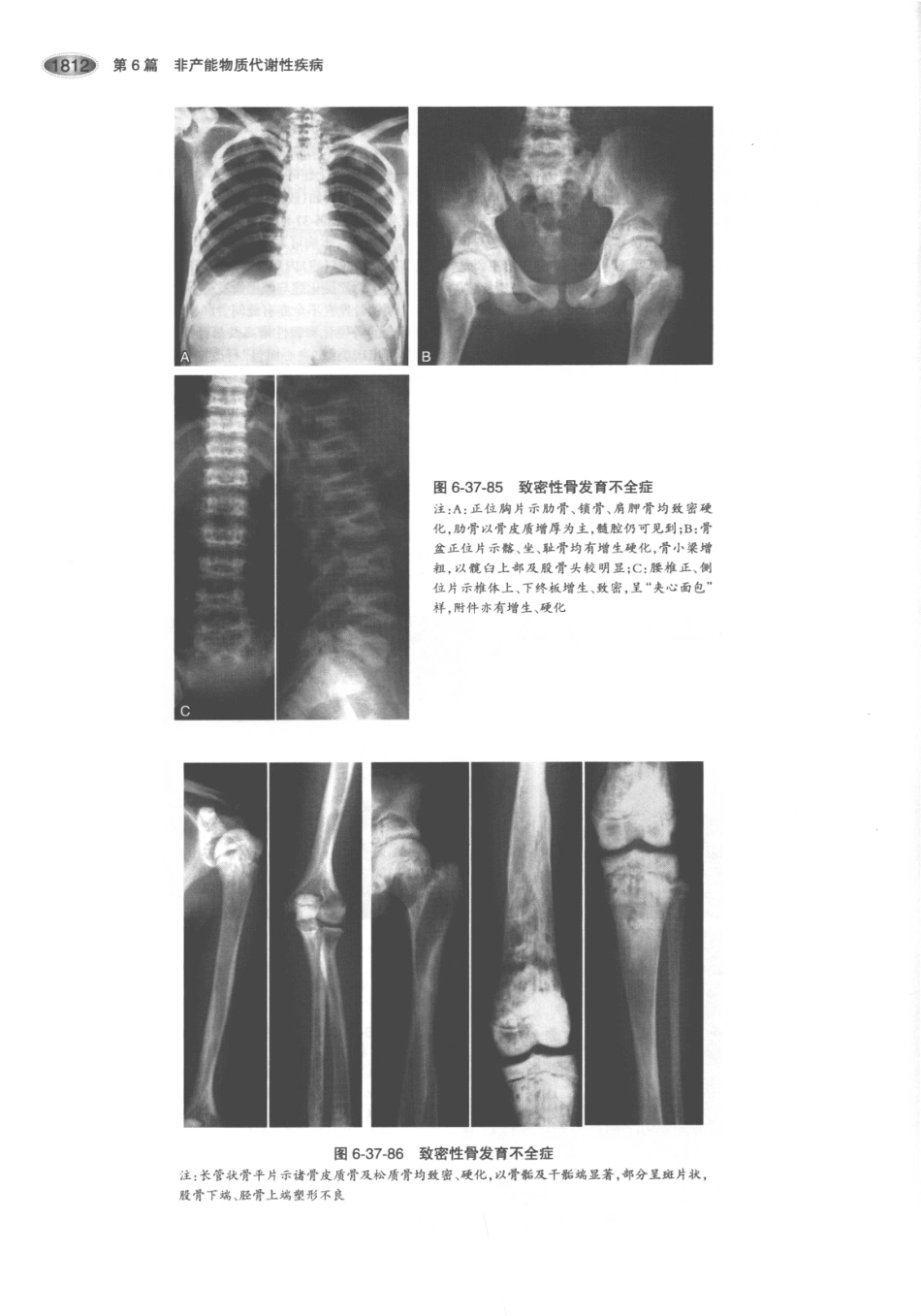内分泌代谢病学  第3版  下册_856-870.pdf_第1页