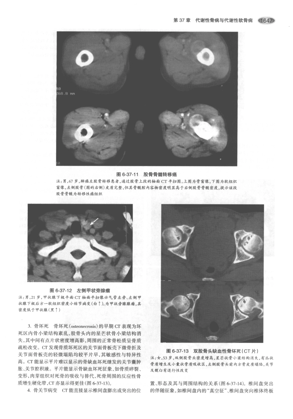 内分泌代谢病学  第3版  下册_691-705.pdf_第1页
