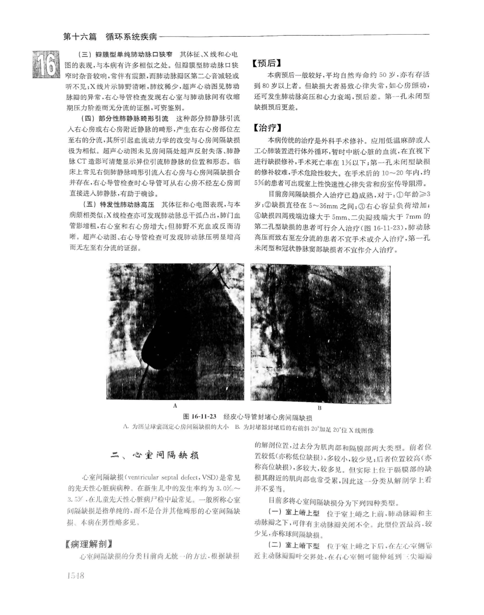 实用内科学（下册）人卫第14版_241-260.pdf_第1页