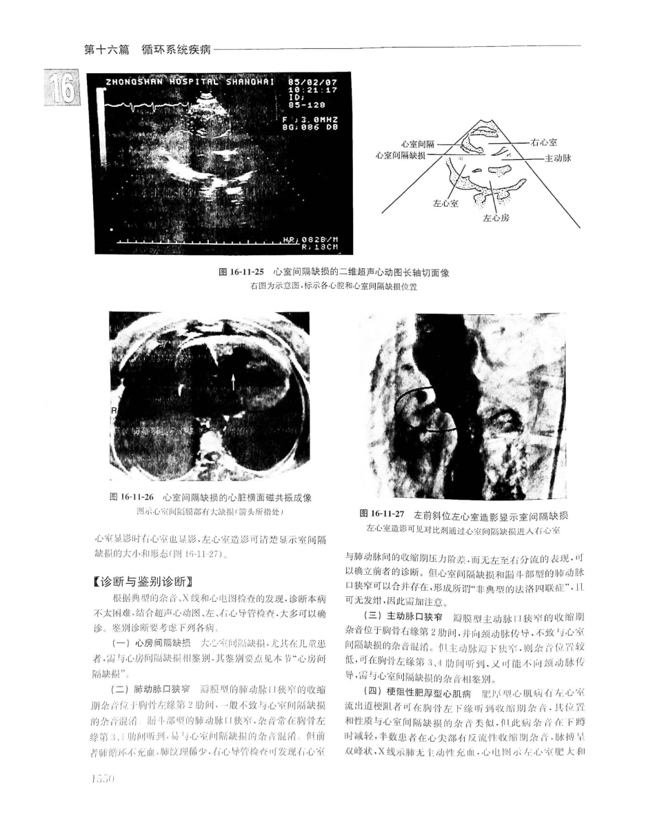 实用内科学（下册）人卫第14版_241-260.pdf_第3页