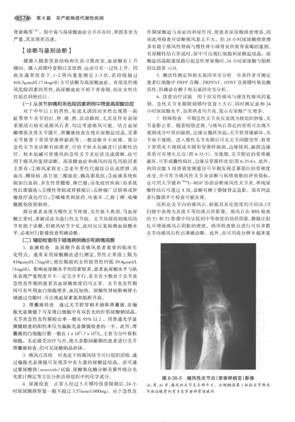 内分泌代谢病学  第3版  下册_616-630.pdf_第3页