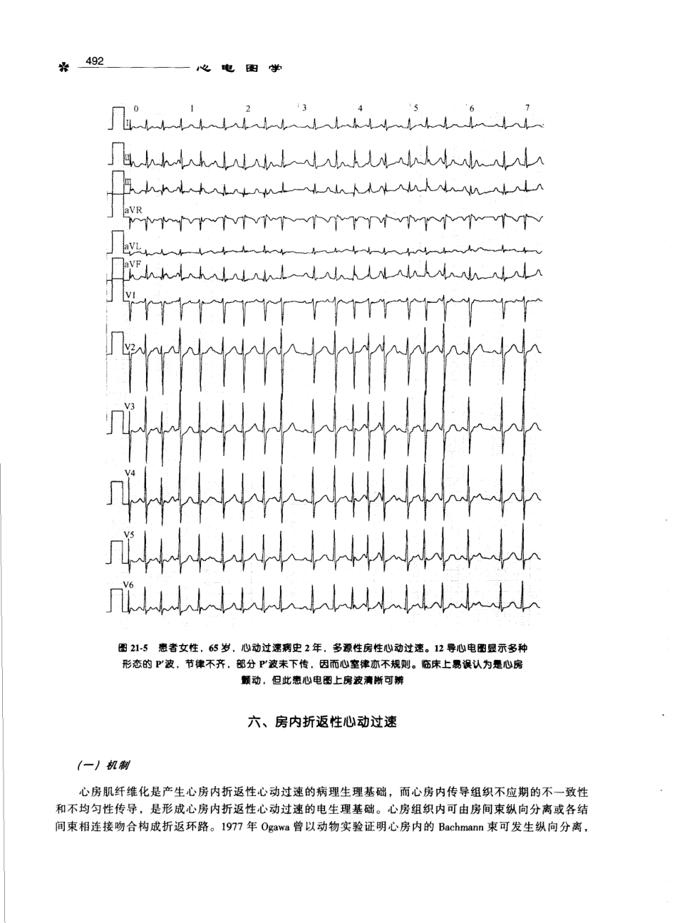 心电图学_11170565_501-600.pdf_第1页