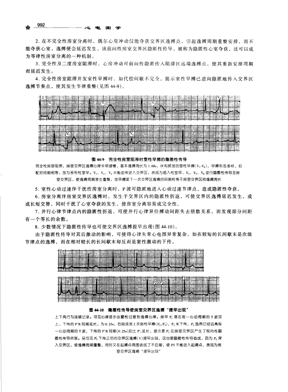 心电图学_11170565_1001-1100.pdf_第1页