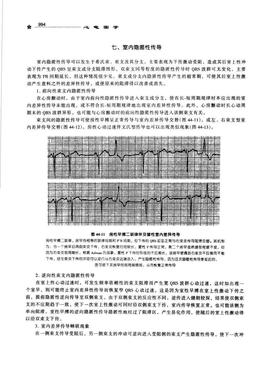 心电图学_11170565_1001-1100.pdf_第3页