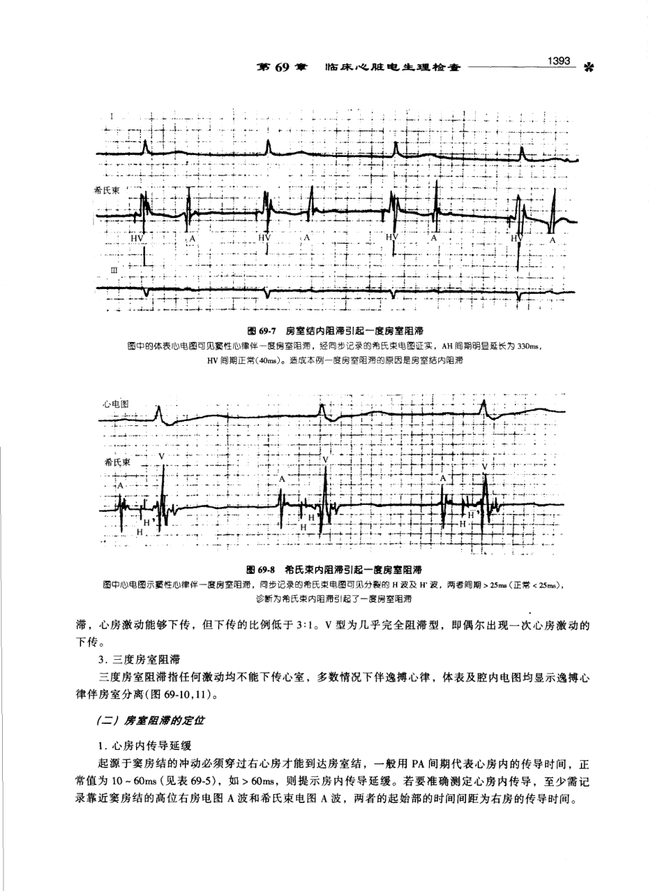 心电图学_11170565_1401-1500.pdf_第2页