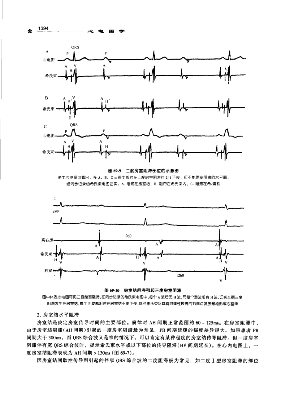 心电图学_11170565_1401-1500.pdf_第3页