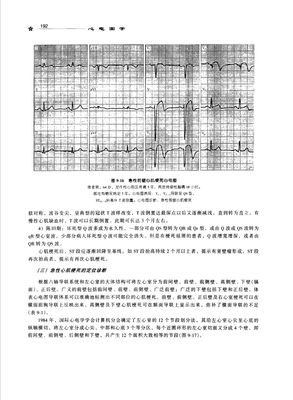 心电图学_11170565_201-300.pdf_第1页