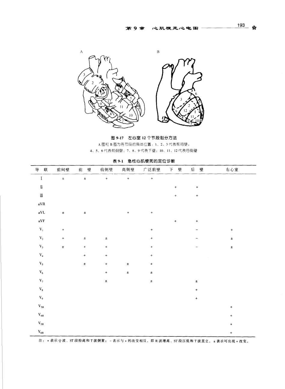 心电图学_11170565_201-300.pdf_第2页