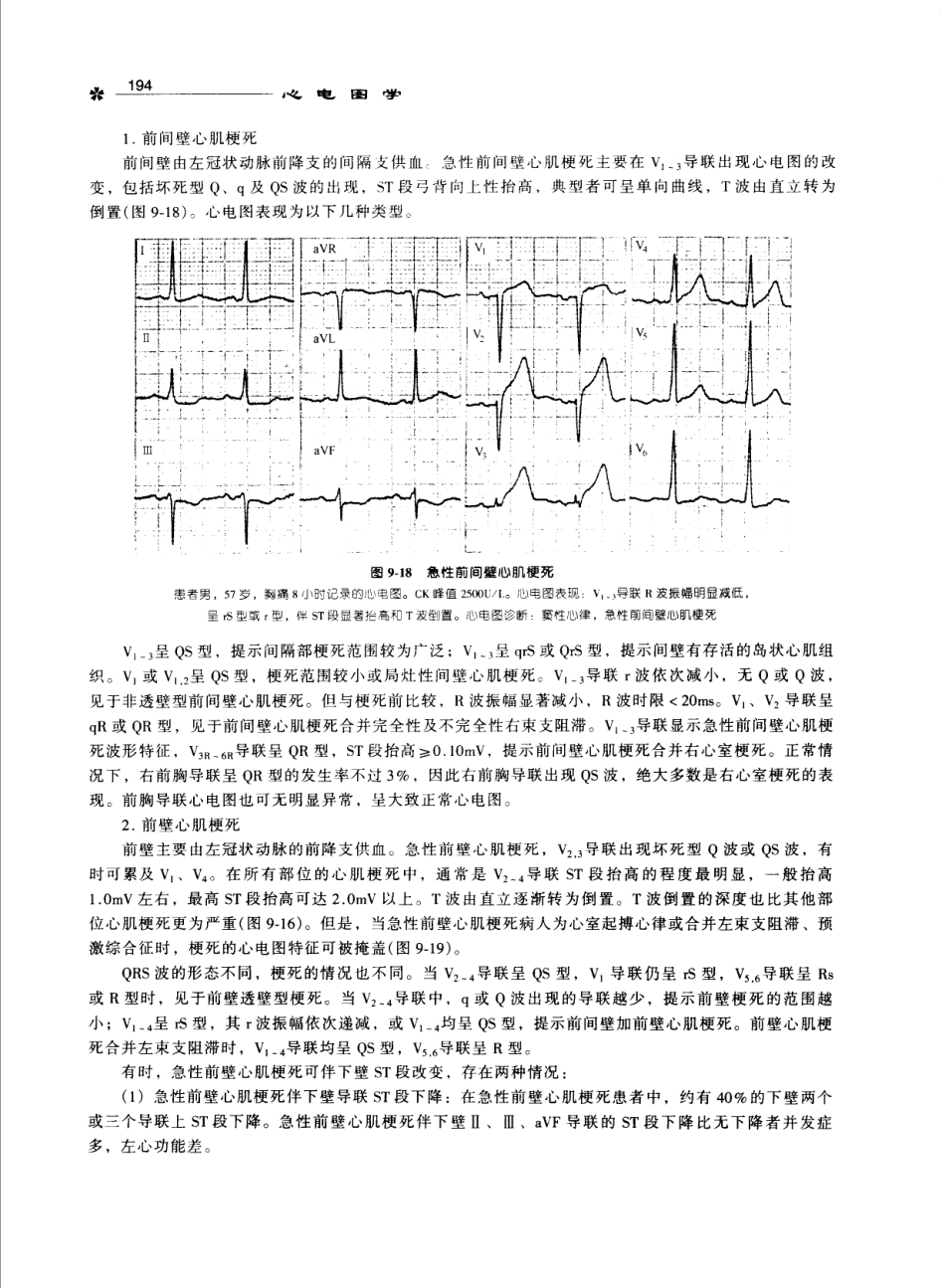 心电图学_11170565_201-300.pdf_第3页