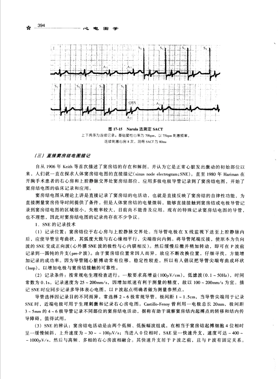 心电图学_11170565_401-500.pdf_第3页