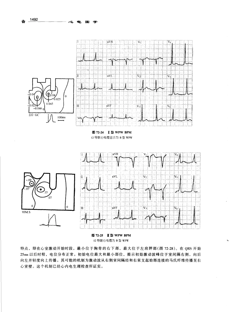 心电图学_11170565_1501-1529.pdf_第1页