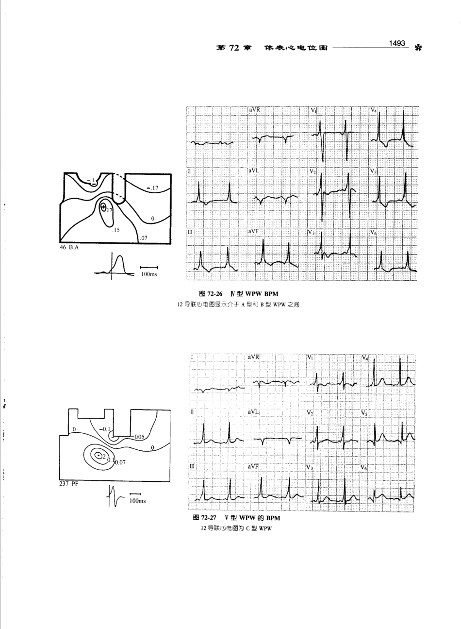 心电图学_11170565_1501-1529.pdf_第2页