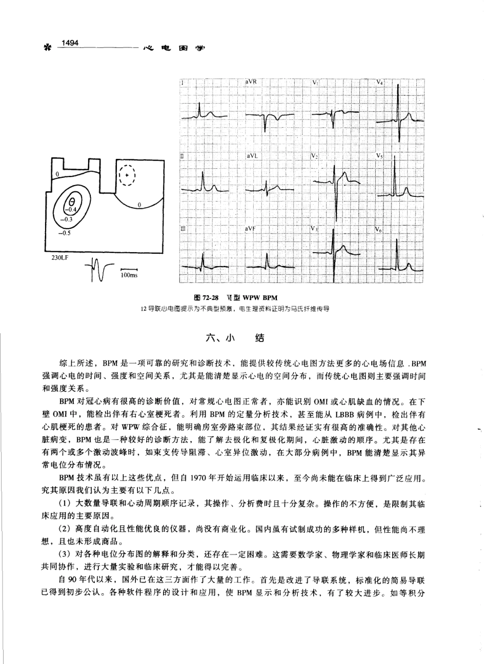 心电图学_11170565_1501-1529.pdf_第3页