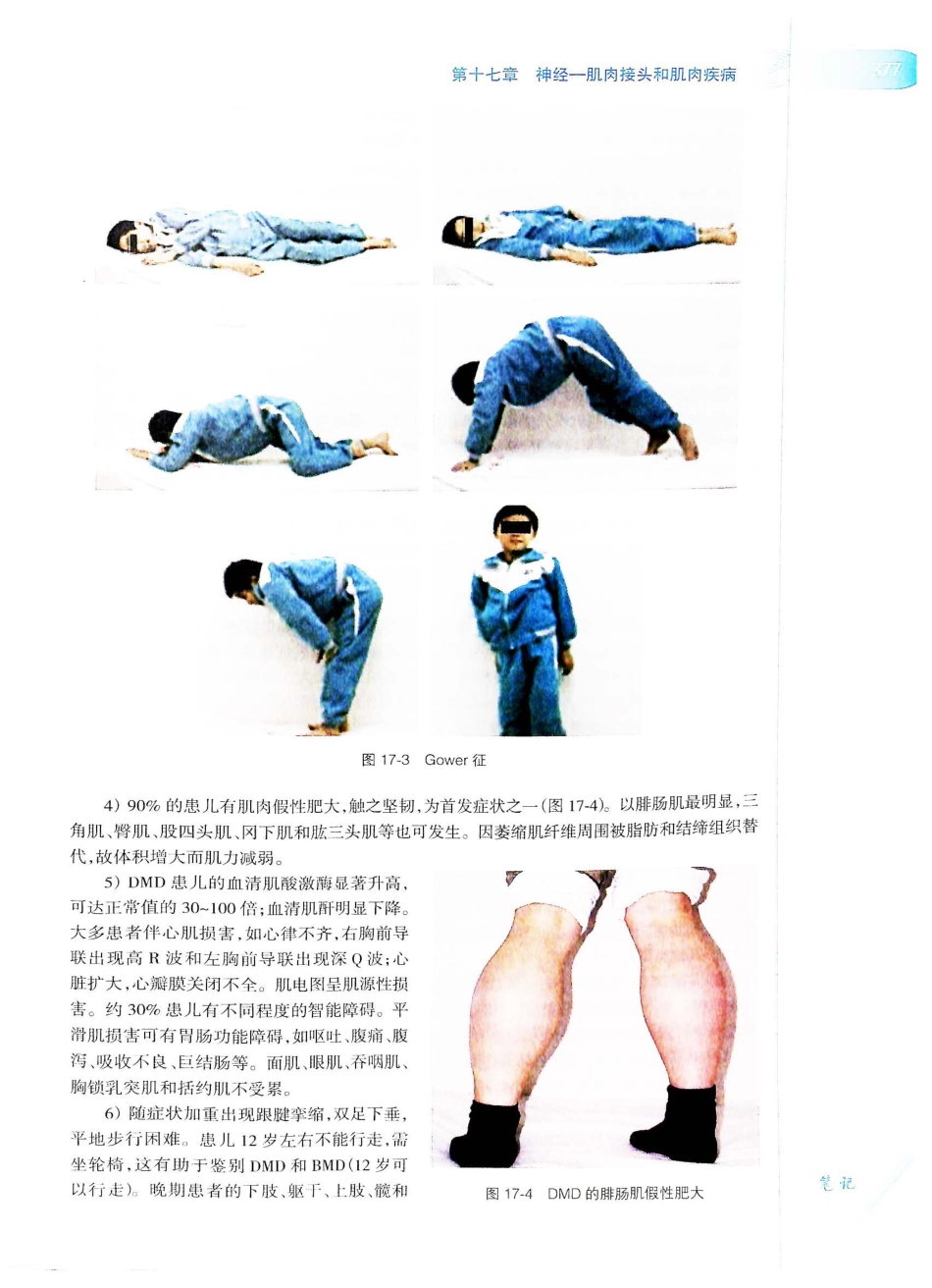 06.神经病学（第7版）_401-420.pdf_第2页