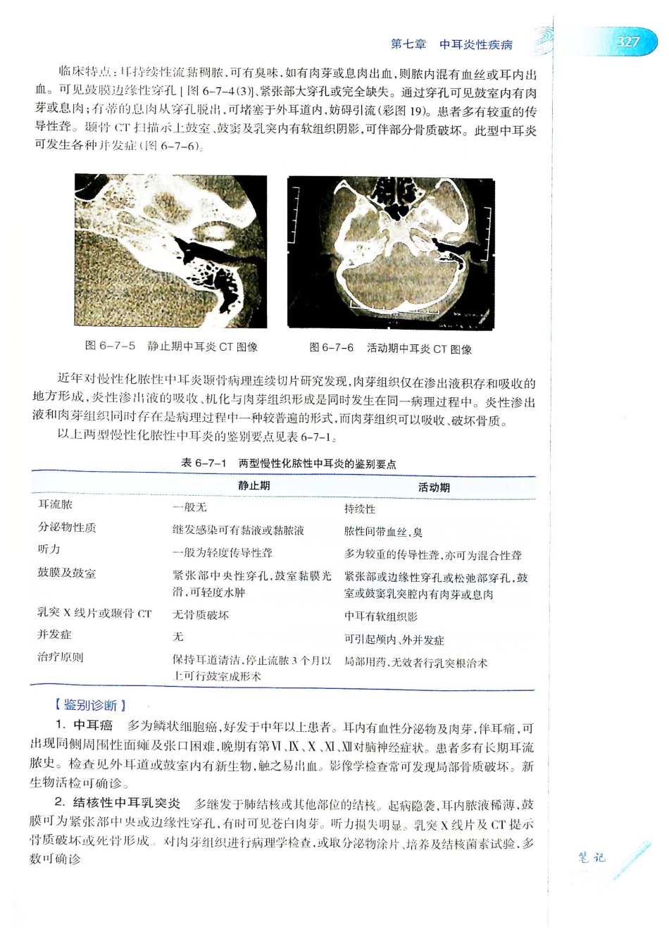 10.耳鼻咽喉头颈外科学（第8版）_361-380.pdf_第2页