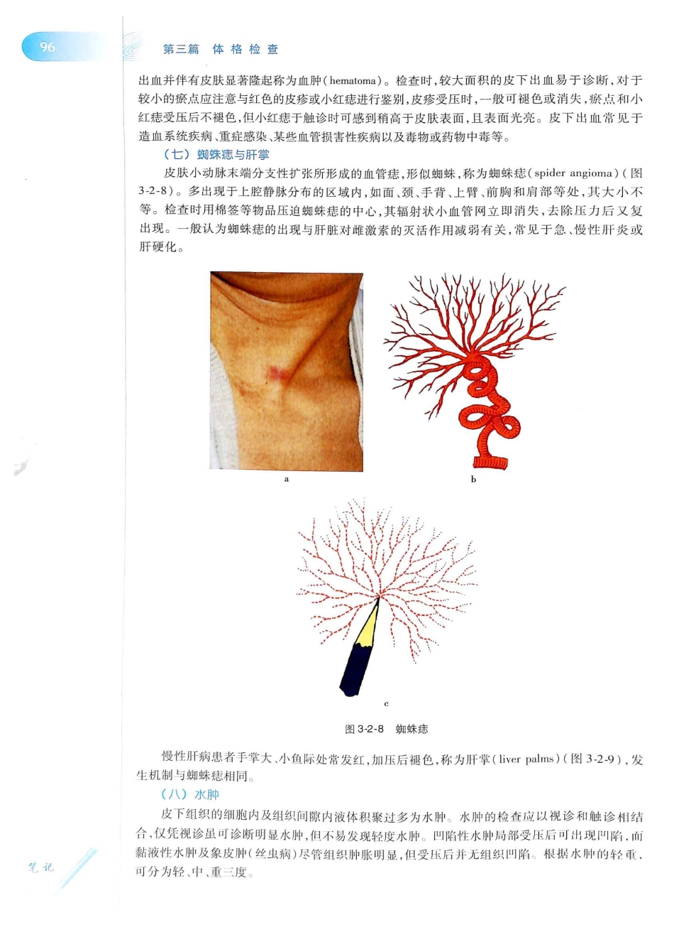 14. 诊断学（第8版）_121-140.pdf_第1页