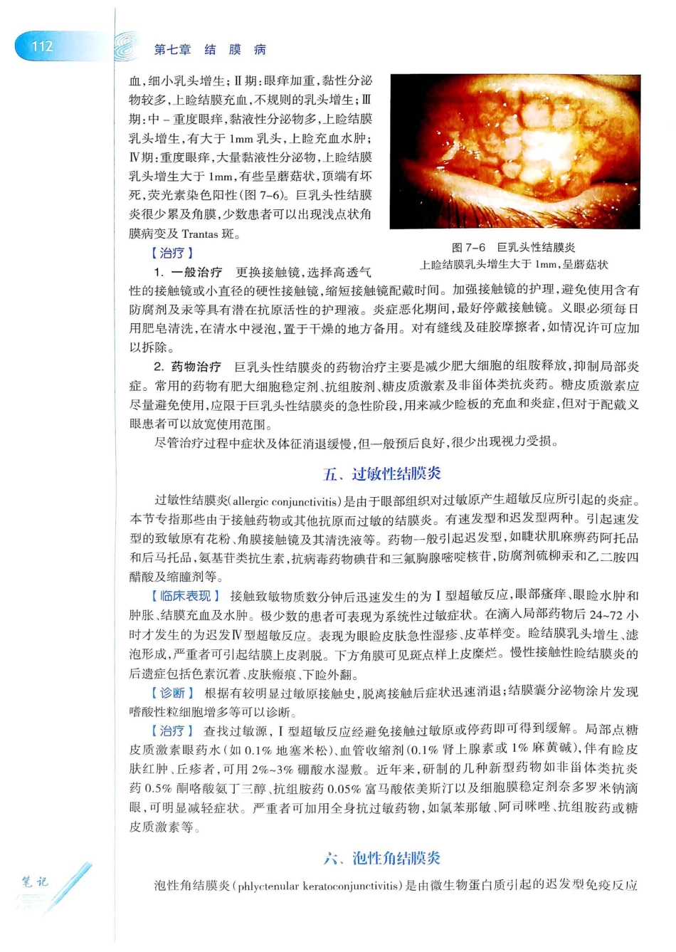 15.眼科学（第8版）_141-160.pdf_第1页
