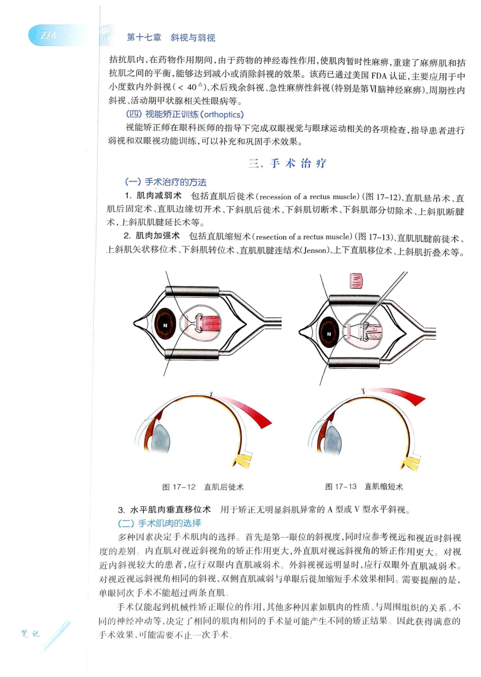 15.眼科学（第8版）_301-320.pdf_第3页