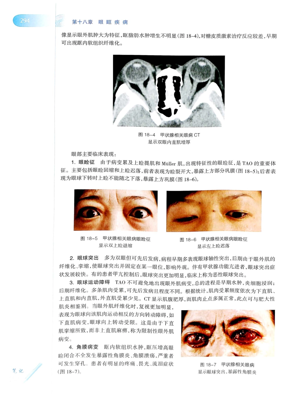 15.眼科学（第8版）_321-340.pdf_第3页
