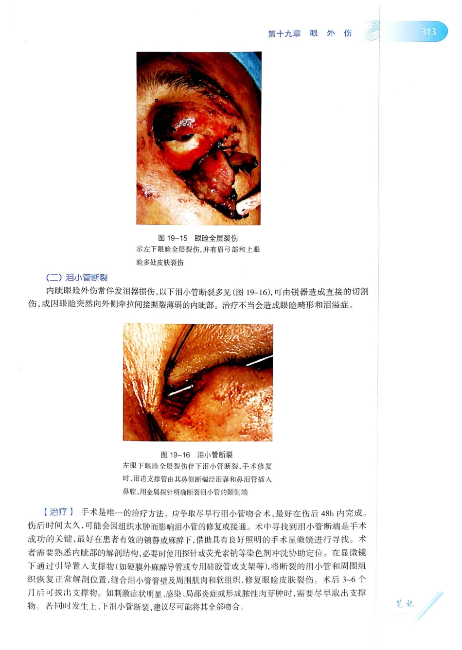 15.眼科学（第8版）_341-360.pdf_第2页