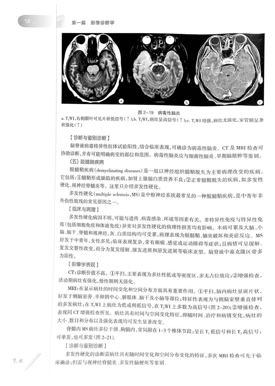 19.医学影像学（第7版）_81-100.pdf_第3页