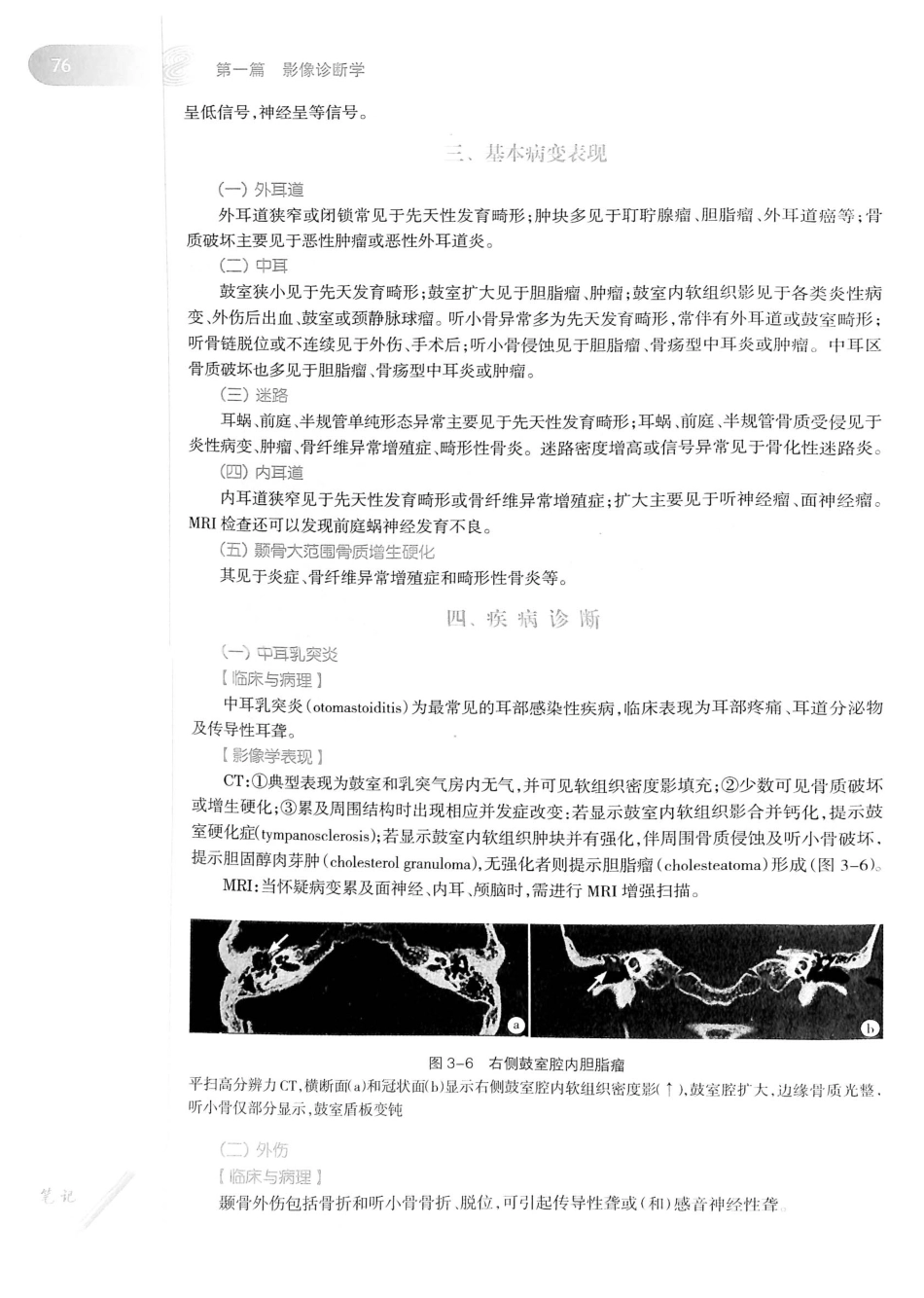 19.医学影像学（第7版）_101-120.pdf_第1页