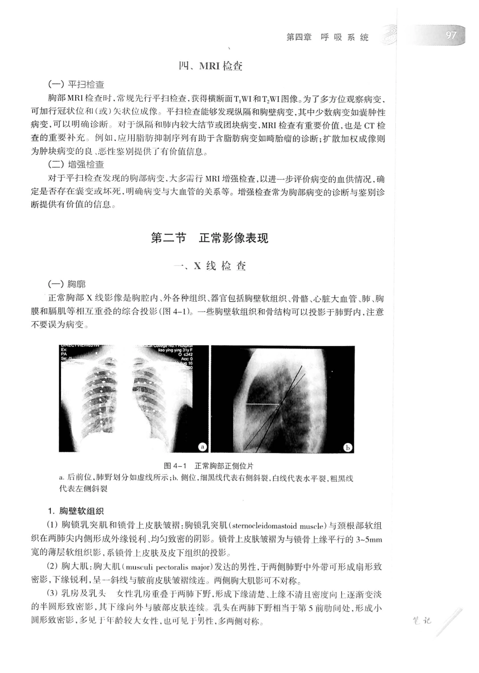 19.医学影像学（第7版）_121-140.pdf_第2页