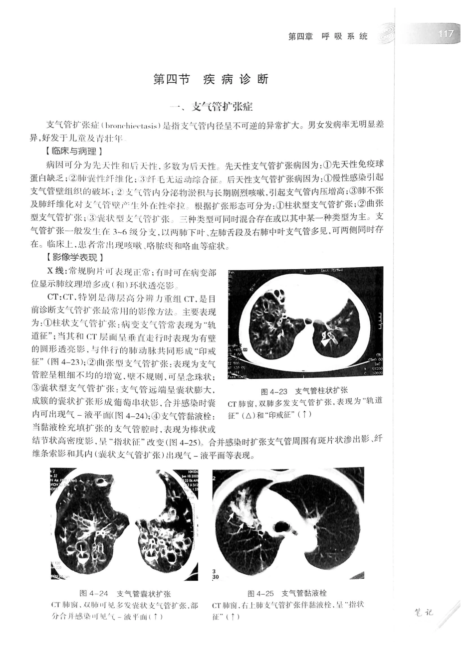 19.医学影像学（第7版）_141-160.pdf_第2页