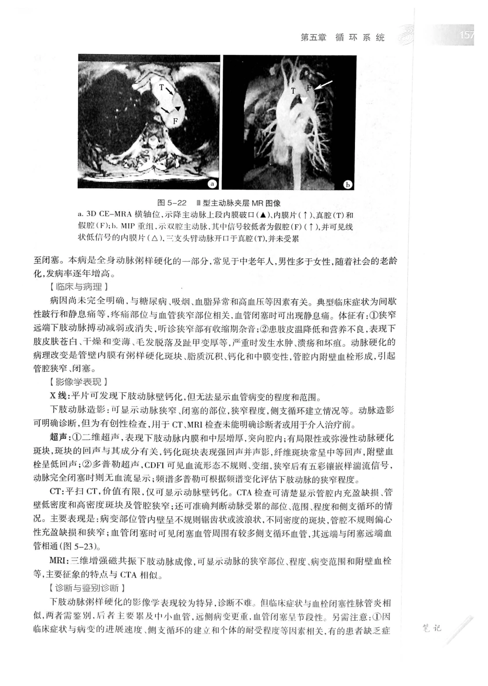 19.医学影像学（第7版）_181-200.pdf_第2页