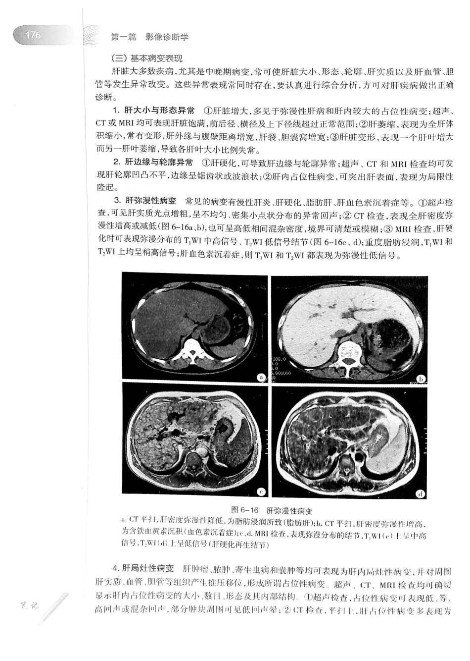 19.医学影像学（第7版）_201-220.pdf_第1页