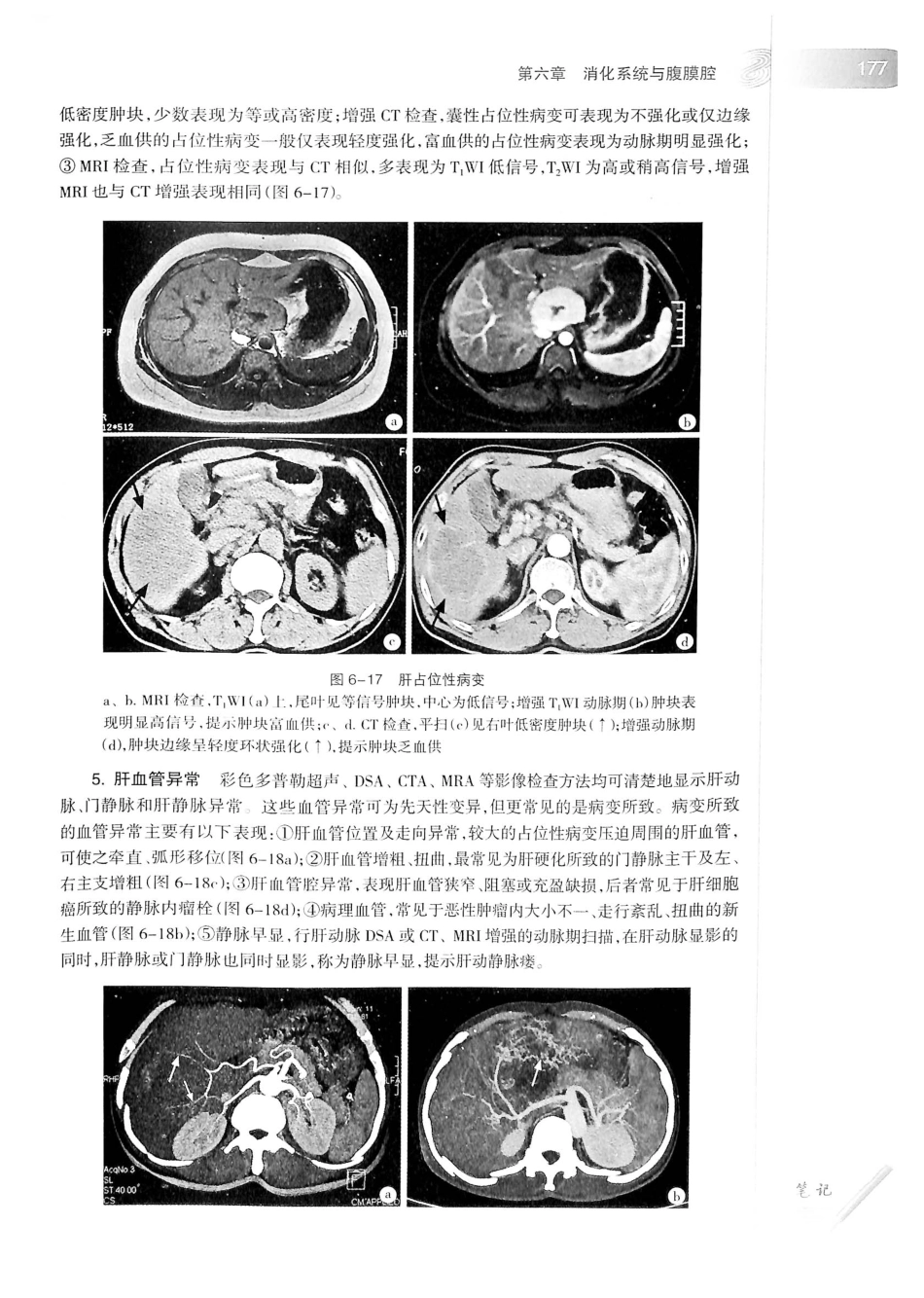19.医学影像学（第7版）_201-220.pdf_第2页