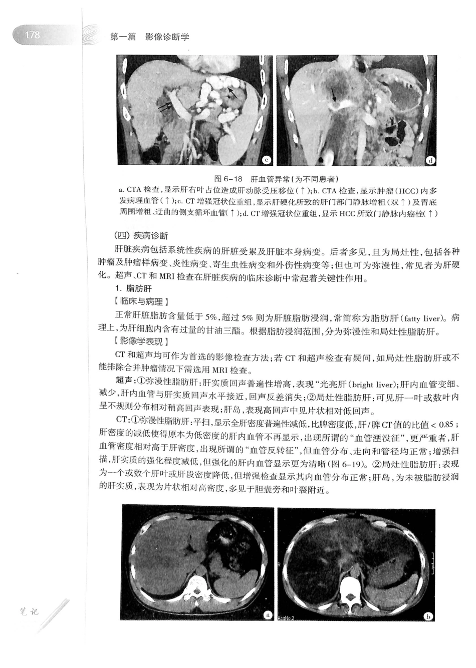 19.医学影像学（第7版）_201-220.pdf_第3页