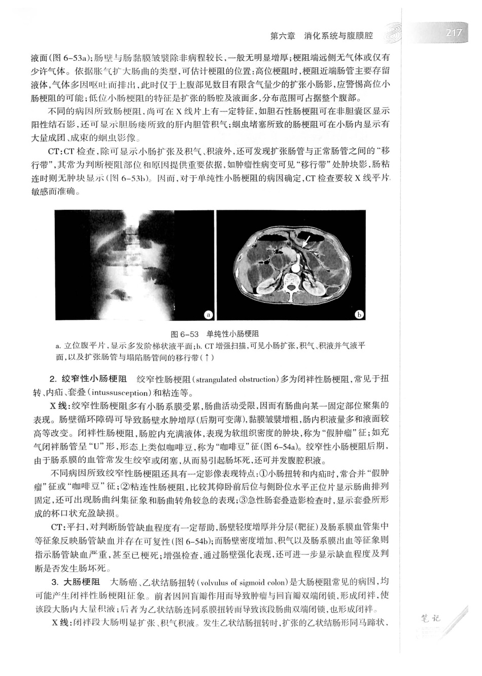 19.医学影像学（第7版）_241-260.pdf_第2页