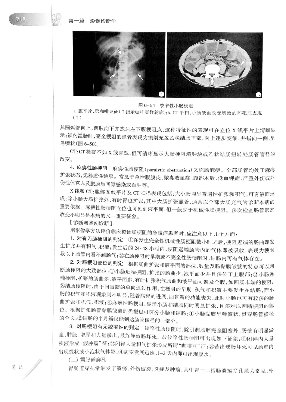 19.医学影像学（第7版）_241-260.pdf_第3页