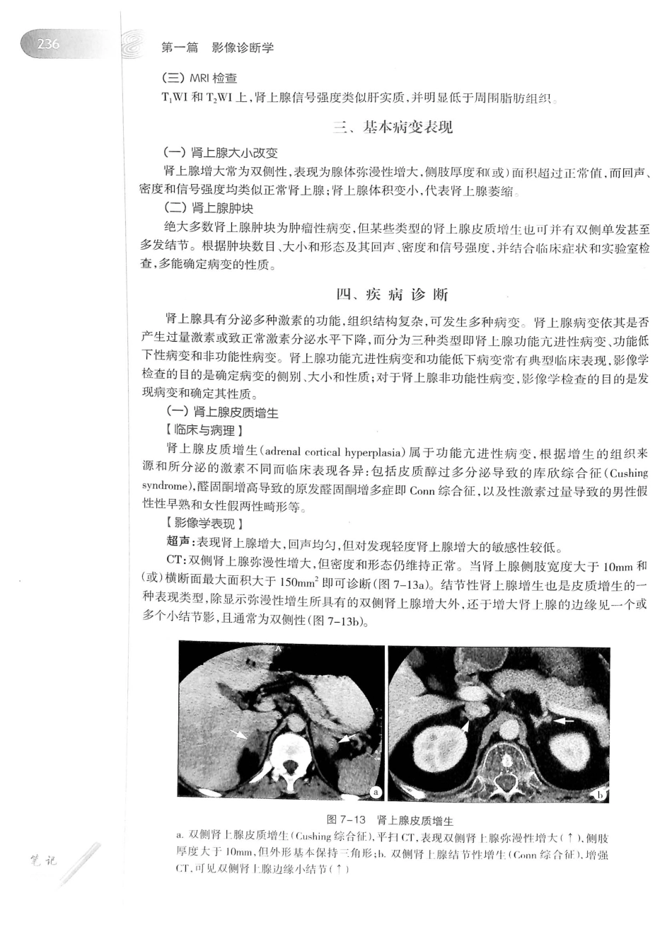 19.医学影像学（第7版）_261-280.pdf_第1页
