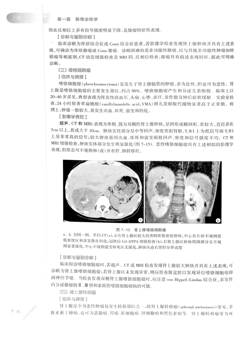 19.医学影像学（第7版）_261-280.pdf_第3页