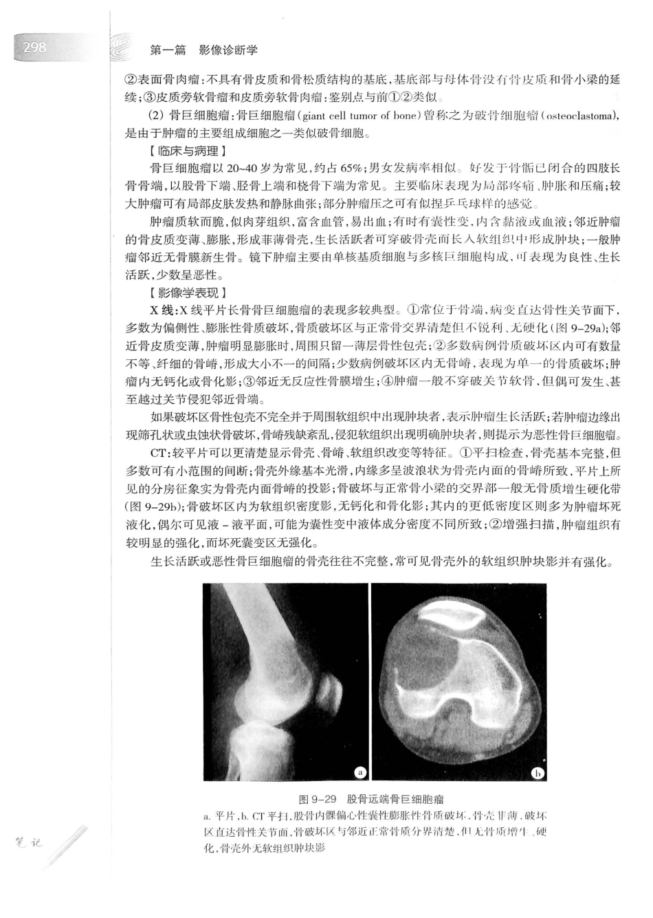 19.医学影像学（第7版）_321-340.pdf_第3页
