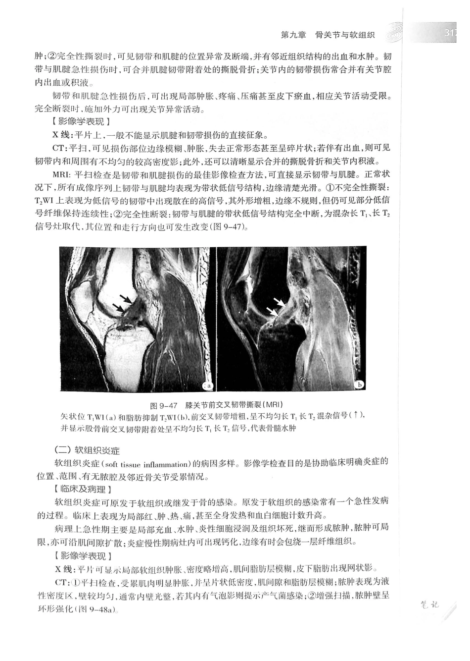 19.医学影像学（第7版）_341-360.pdf_第2页