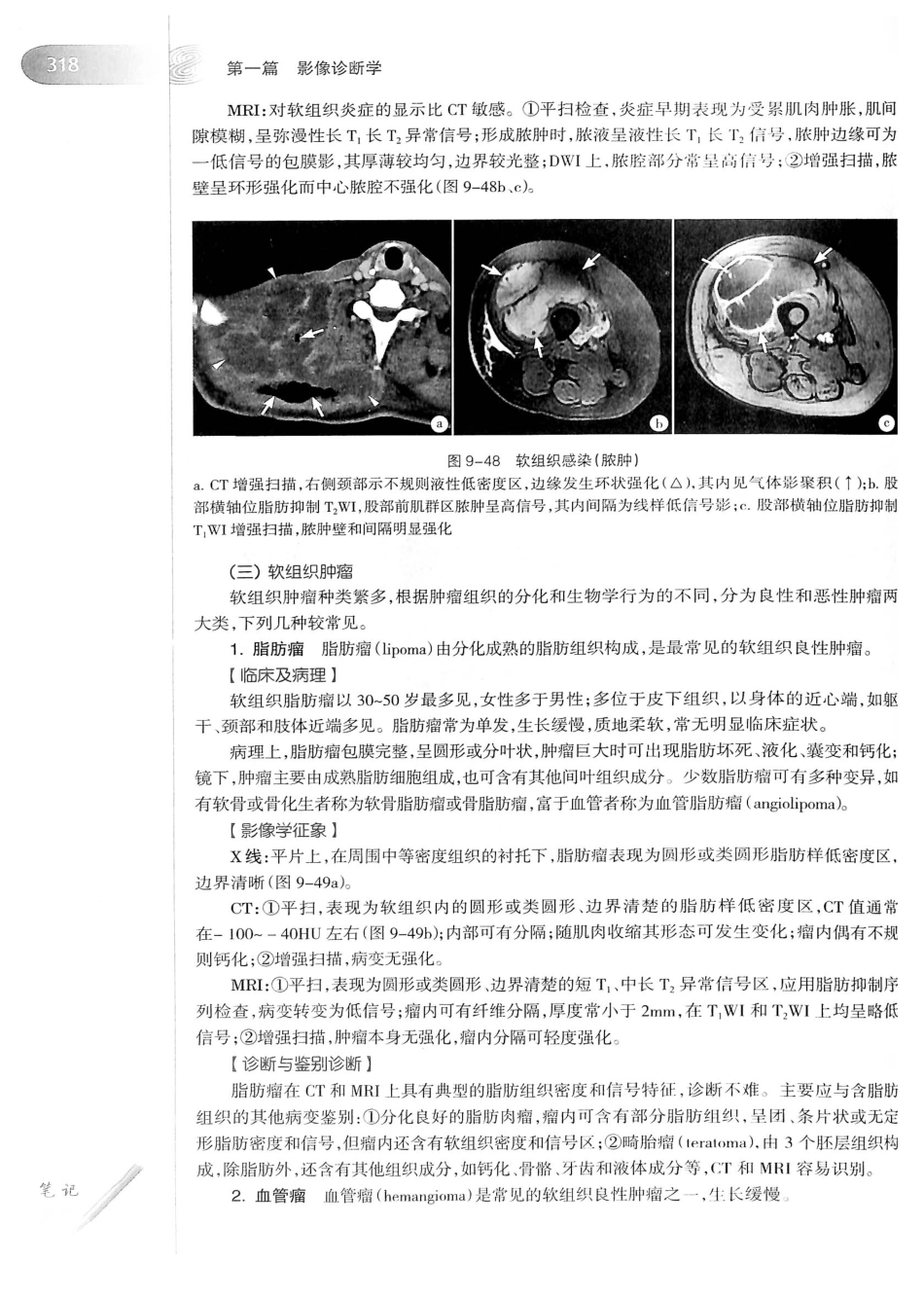 19.医学影像学（第7版）_341-360.pdf_第3页