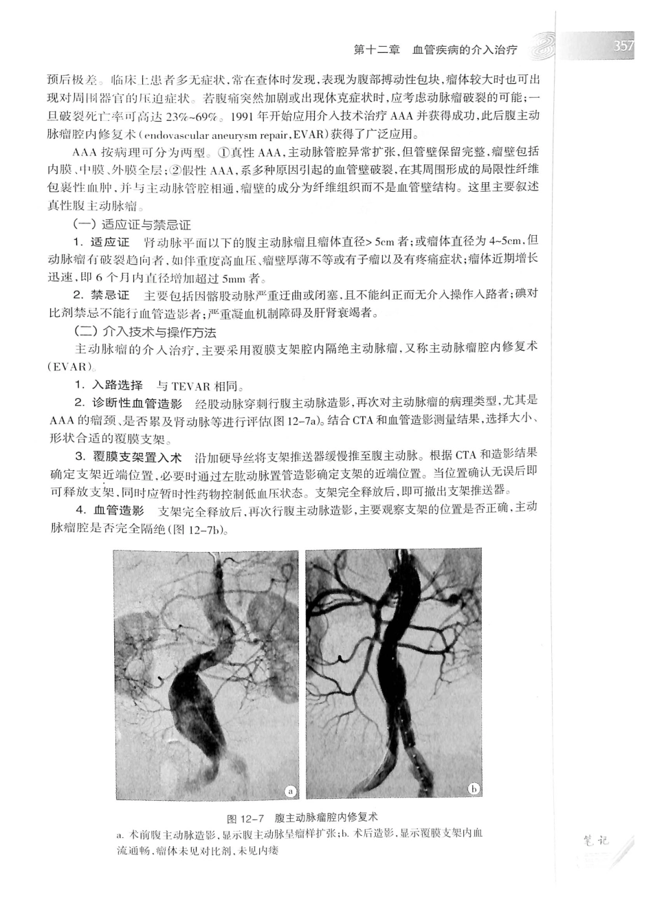 19.医学影像学（第7版）_381-400.pdf_第2页