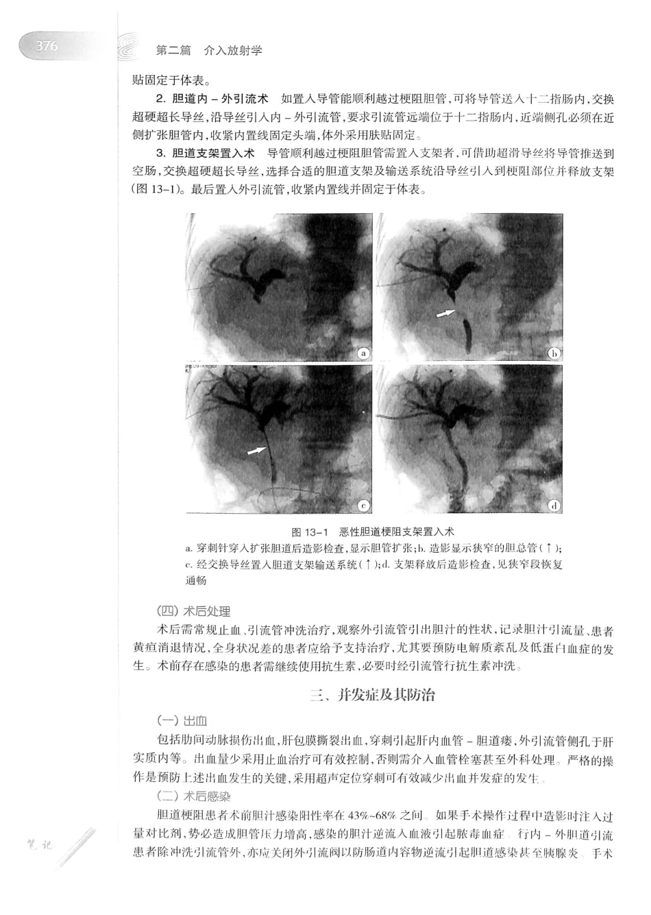 19.医学影像学（第7版）_401-420.pdf_第1页