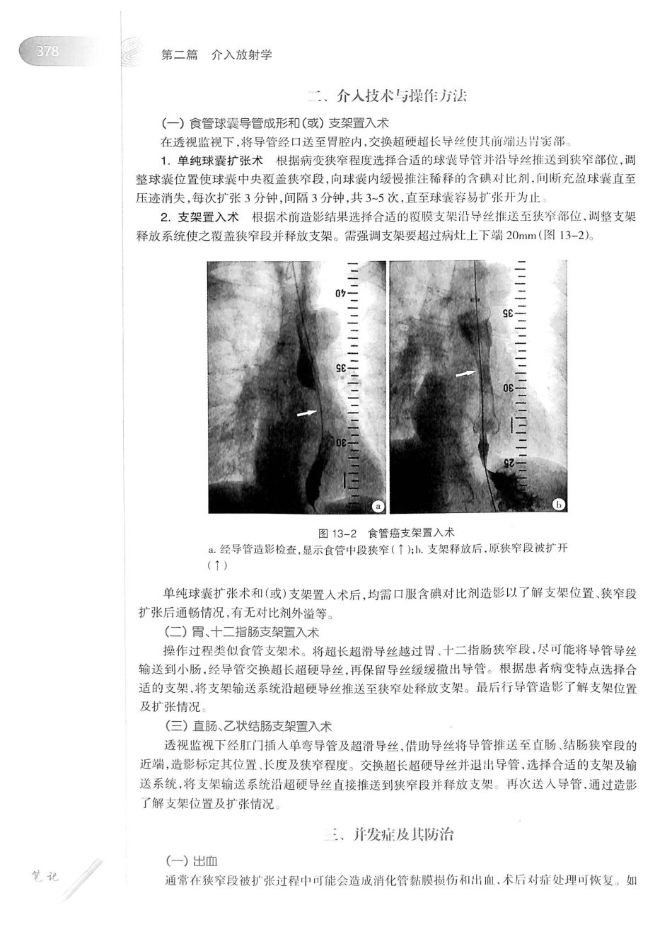 19.医学影像学（第7版）_401-420.pdf_第3页