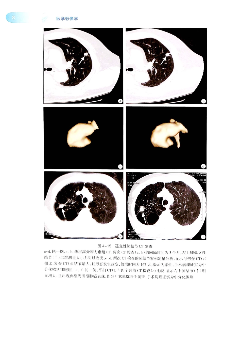 19.医学影像学（第7版）_441-445.pdf_第1页