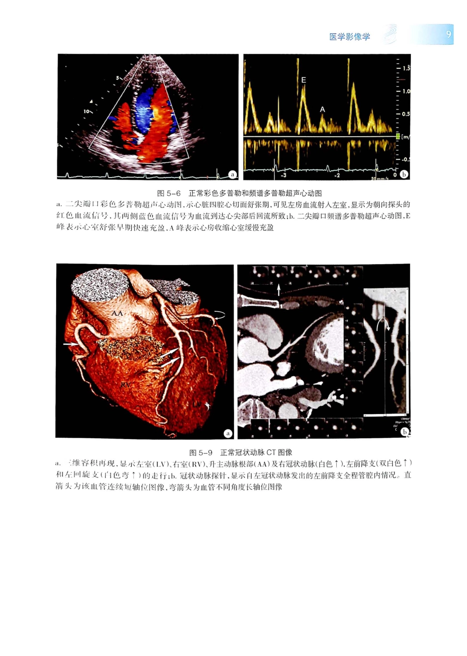 19.医学影像学（第7版）_441-445.pdf_第2页