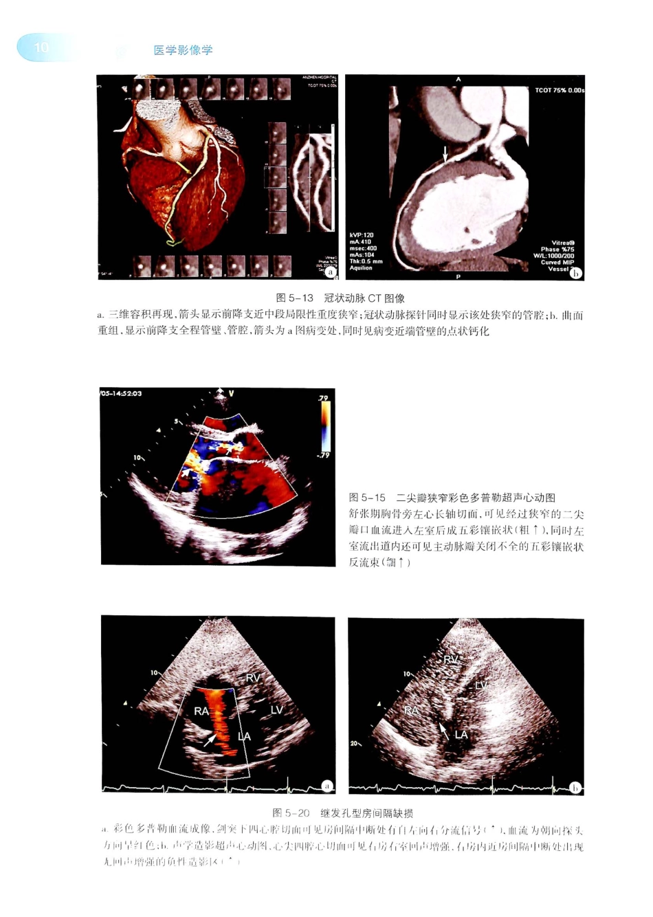 19.医学影像学（第7版）_441-445.pdf_第3页