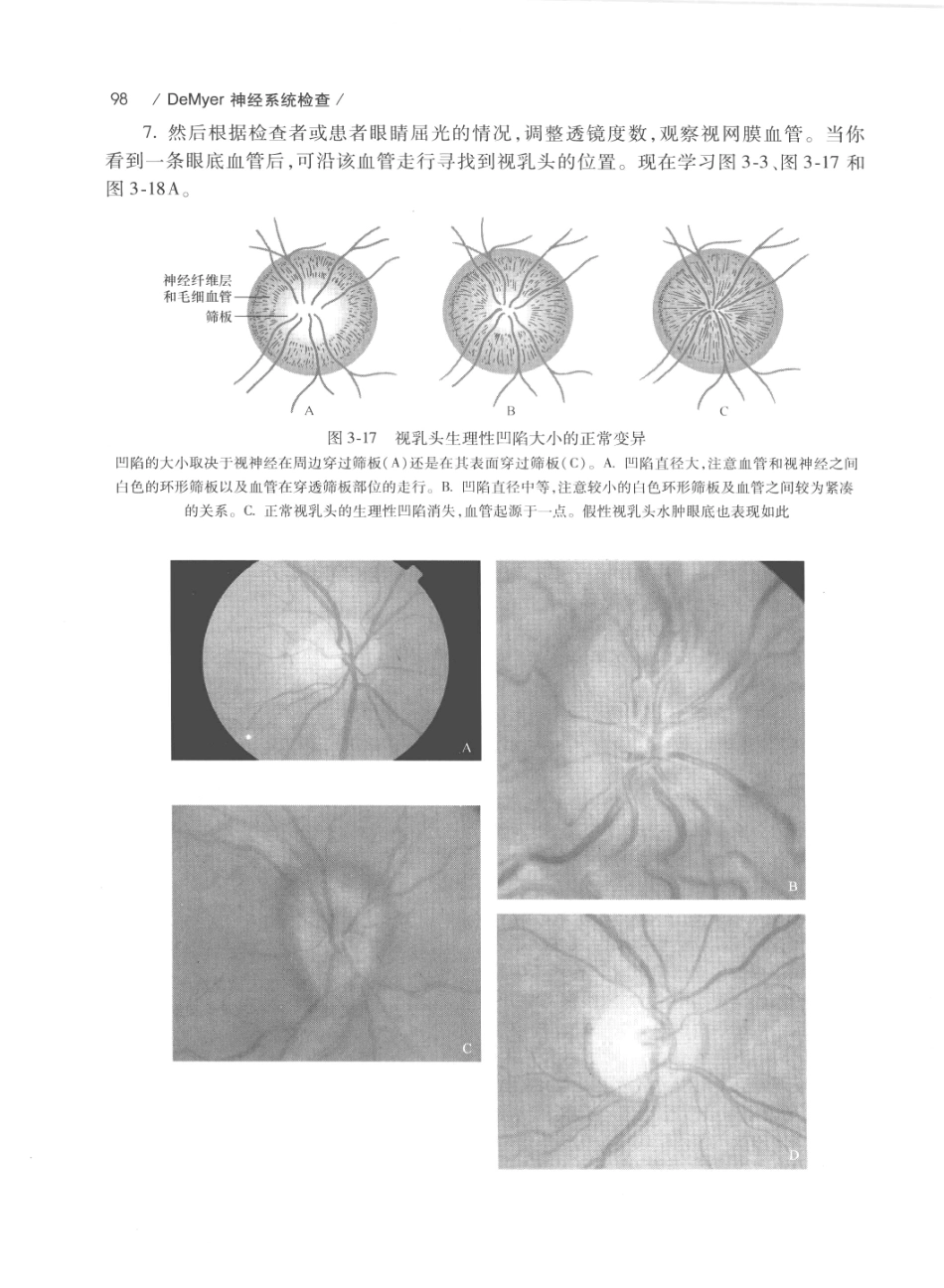 DEMYER+神经系统检查++原书第6版_13200349_121-140.pdf_第2页